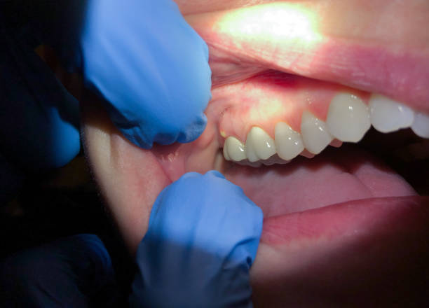 Best Emergency Treatment for Toothache in South Oroville, CA