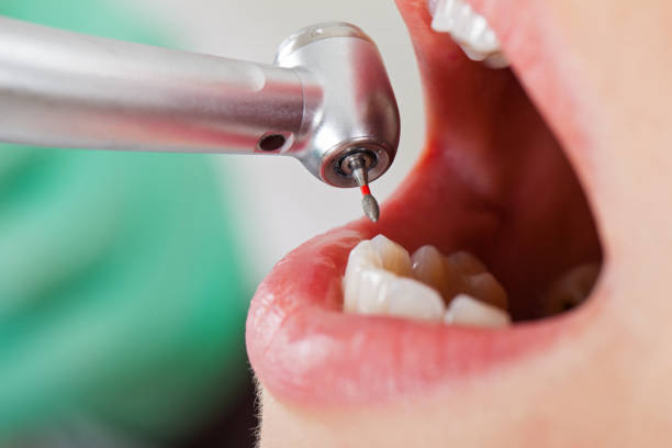 Best Weekend Emergency Dentist in South Oroville, CA